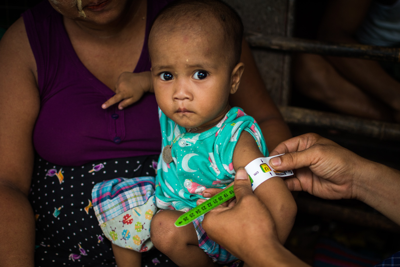 Screening for malnutrition using the Mid-Upper Arm Circumference