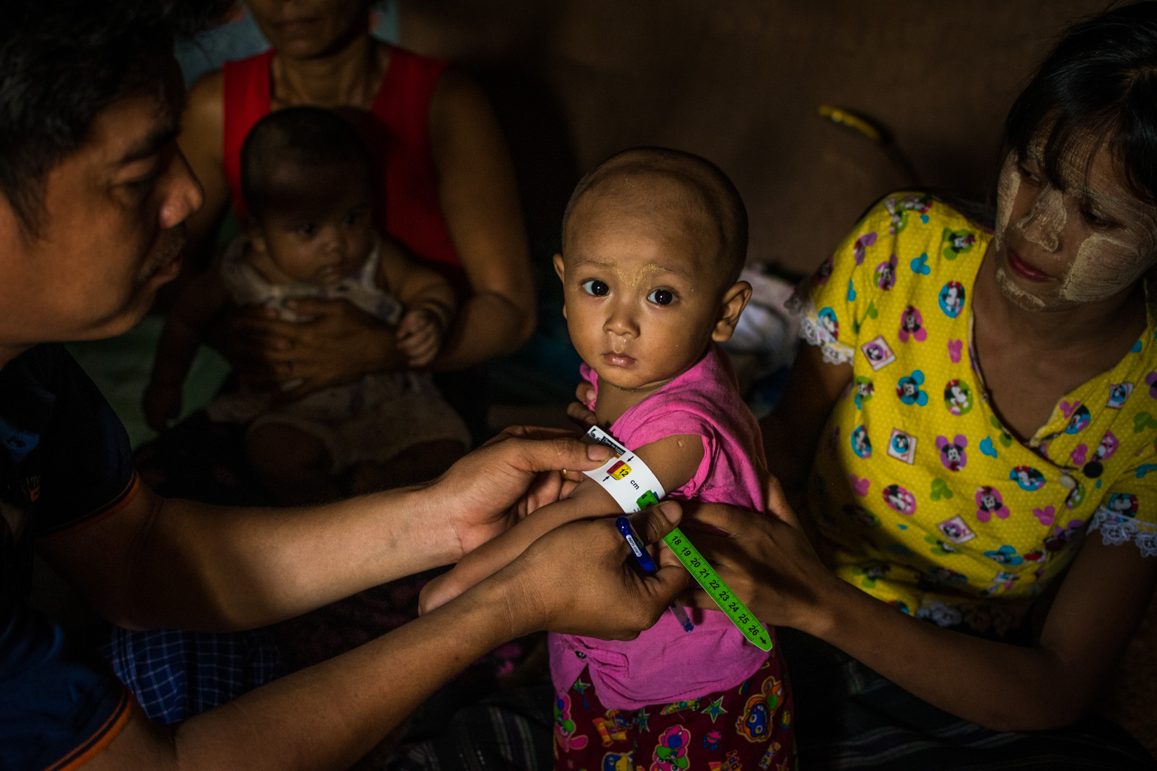 Screening for malnutrition using the Mid-Upper Arm Circumference